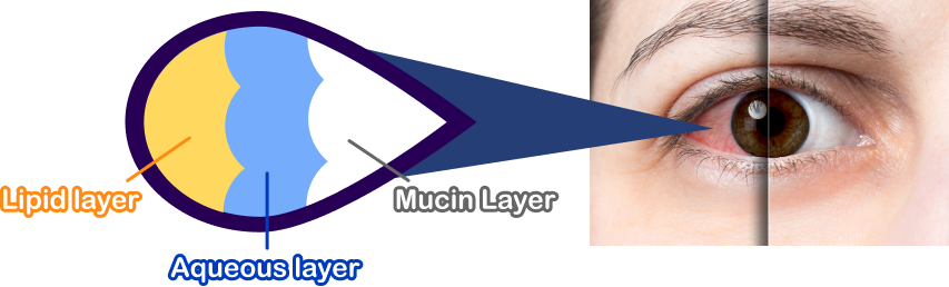 CMER Eye Center_ dry eyes causes