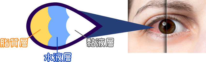 希玛眼科中心_乾眼症成因