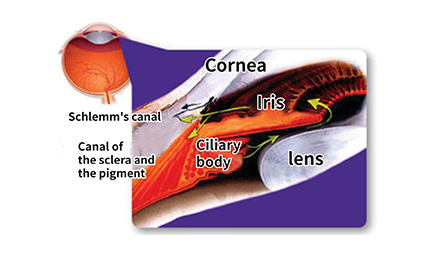  _CMER Eye Center_ Secondary Glaucoma